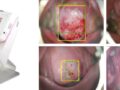 엔티엘헬스케어, 자궁경부암 AI 영상판독 시스템으로 해외 공략