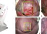 엔티엘헬스케어, 자궁경부암 AI 영상판독 시스템으로 해외 공략